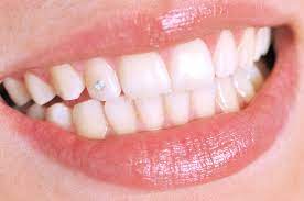 Teeth Whitening & Gem Kit